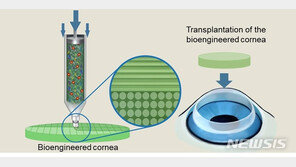 국내 연구팀, 3D 프린팅 기술로 인공 각막 제작 성공
