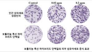 보톡스 단점 극복한 넥스젠의 엔지니어드 보툴리눔 톡신, 미국 특허 등록