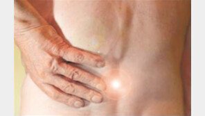 척추관협착증, 추간공 확장 시술로 통증 완화