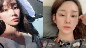 ‘효리네 민박’ 출연 모델 정담이, 거리서 무차별 폭행당해 ‘뇌진탕’