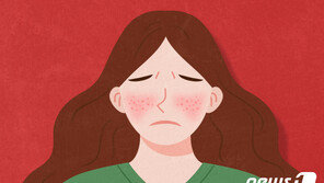 면역도 지나치면 병…양쪽 뺨 붉게 물들이는 ‘루푸스’