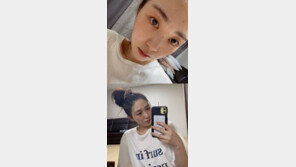 AOA 출신 권민아 “이벤트 피부관리 했다가 피부염…절대 하지마”