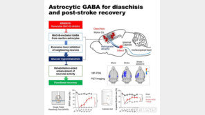 뇌졸중 후유증 치료 새 길…‘기능해리’ 메커니즘 첫 규명