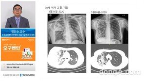 일성신약, 항생제 오구멘틴 웹 심포지엄 성료… 의료진 587명 참여