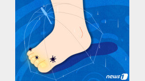 발가락 사이 간질간질…가족 양말 함께 쓰다간 감염