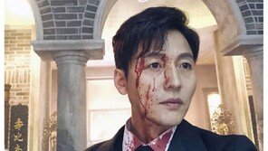 이정진, 피범벅 사진 올리며 “사칭하면 다른 세상 보여주마”