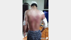 잔혹 후배커플에 불·물고문 당한 20대…긴급생계비 등 지원