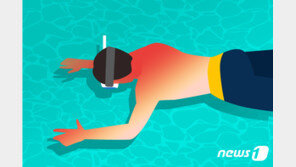 물놀이 뒤 뒷목이 따끔…‘일광화상 피부 껍질 벗기지 마세요’