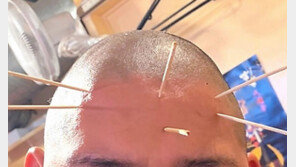 선수 머리에 이쑤시개 꽂고, 불에 달군 집게로 지져… 대학 럭비코치 엽기행각에 日 ‘발칵’