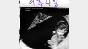 황지현, 결혼 10개월 만에 임신 소식 직접 전했다…“10주차, 입덧 힘들지만”