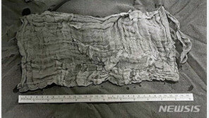 제왕절개 출산후 구토·설사, 알고보니 뱃속에 15㎝거즈