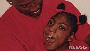 美 20세 여성 사망선고 두 시간만에 장례식장서 생존 확인