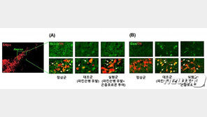 “곤충 허물 벗을 때 나오는 호르몬이 파킨슨병 증상 개선”