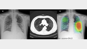 인간보다 정확하고 빠르게 진단하는 AI, 의료현장서 존재감 높인다
