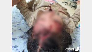 ‘맞는 안전모 없다’ 4살 짚트랙 타다 중상…고작 400만원 벌금