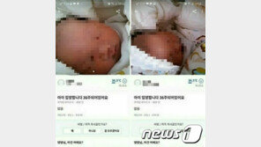 ‘아기 20만원 거래’ 엄마는 왜…‘출생신고’ 부담됐나