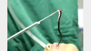 “숨 쉬기 힘들어” 병원 가니 목구멍에 거머리가 꿈틀…