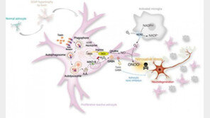 치매의 새로운 원인 ‘별세포의 공격’…국내 연구진 밝혀냈다
