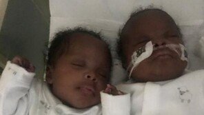 코로나19로 혼수상태서 쌍둥이 낳은 英 엄마 “믿을 수 없었다”