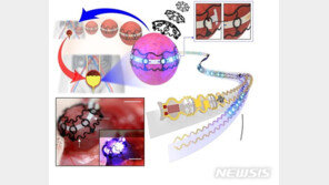 전자소자 방광에 입혀 소변배출…소변줄 고통 ‘아웃’