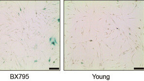 국내 연구진, 시간 거꾸로 돌리는 ‘회춘 기술’ 찾았다