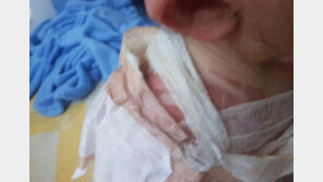 “화상 입은 우리 아이 좀”…확진 아버지 사연에 손 내민 의사들 