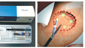 홍합 추출물로 만든 생체접착제, 年매출 500억이상 기대