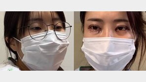 “잘 된 것 같냐”…이세영, ‘쌍꺼풀 수술’ 전후 모습 공개