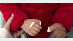 “엄지손가락 수술” 3살 손녀에 스마트폰 쥐여준 결과