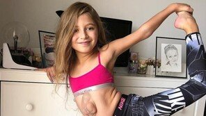 가슴 밖으로 나온 ‘단 하나뿐인 심장’을 가진 소녀