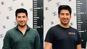 하루만에 5cm 쑥… 키 크는 수술받은 남성 후기 ‘대만족’