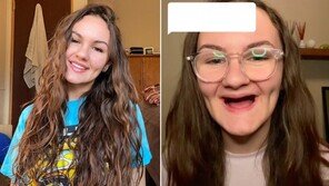 입 벌려 틀니 빼낸 20대…“마약하면 이렇게 된다” (영상)