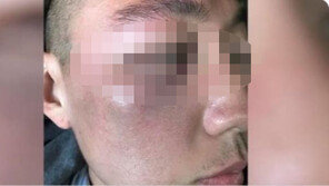 LA 한인타운서 한국계 남성 무차별 폭행 “‘중국바이러스’라며 비하”