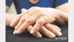 손가락 마디 붓고 극심한 통증… 일상 무너뜨리는 ‘류머티즘관절염’