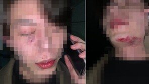 춘천 ‘묻지마 폭행’ 용의자 검거…“술 취해 그랬다”