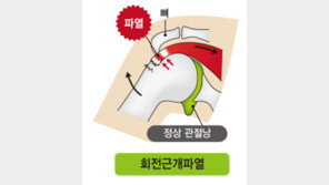 중장년 어깨 통증, ‘오십견’ 치부해 방치하면 안돼