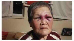 백인남성 막대기로 반격한 亞할머니, 후원금 100만달러 기부한다