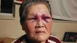 묻지마 폭행 피해 亞할머니, 인종차별과의 싸움에 10억여원 기부