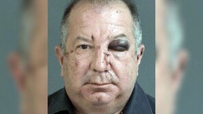 애인 폭행하던 美 변호사, 다른 여성 강펀치에 ‘KO’