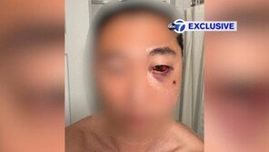 “동양인, 항상 유리해” 5살 앞 폭행…美 증오범죄 또?
