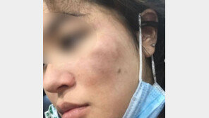 성희롱성 발언 후 폭행… 한국계 美 여성에 또 증오범죄