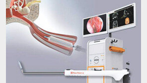 이관풍선확장술 신의료기술 고시… 연구개발 선순환