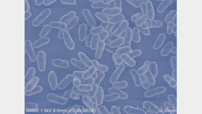 유산균, 노년층 구강건강 개선효과 ‘톡톡’