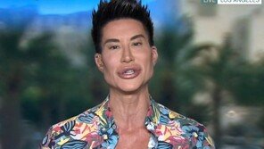 20년 동안 1000회 성형 11억 쓴 남성 “성형은 창의성 실현하는 것”