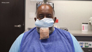 “코로나 걸린 뒤 혀 부풀어”…美 ‘대설증’ 공포 확산