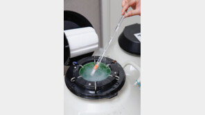 맞춤형 난자동결보존으로 임신 성공률 높인다 