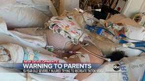 틱톡 챌린지 따라하다…美 13세, 3도 화상 ‘중태’