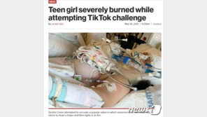 美 10대 소녀, ‘틱톡 챌리지’ 하다 3도 화상 입고 중환자실行