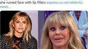 수천번 성형한 ‘007 본드걸’의 후회…“얼굴에 손대지 마”