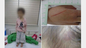 극단적 선택 신고로 출동한 곳엔…학대받는 아이 있었다